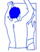 melanoma1.jpg (3532 bytes)