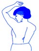 melanoma2.jpg (3097 bytes)