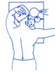melanoma4.jpg (3025 bytes)